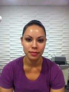 NuFACE face toning San Diego Nonsurgical face lift san diego